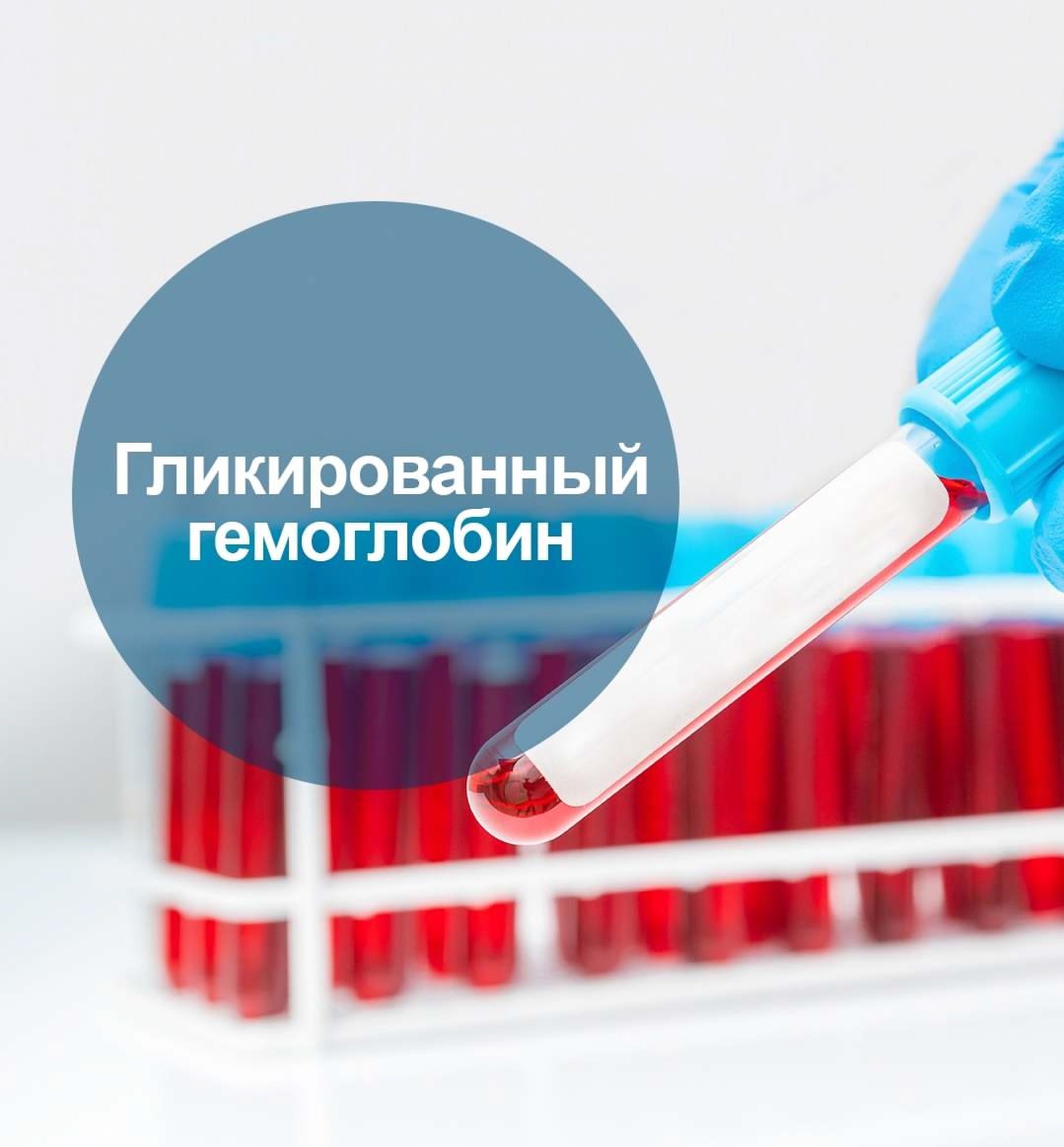 ​Гликированный гемоглобин