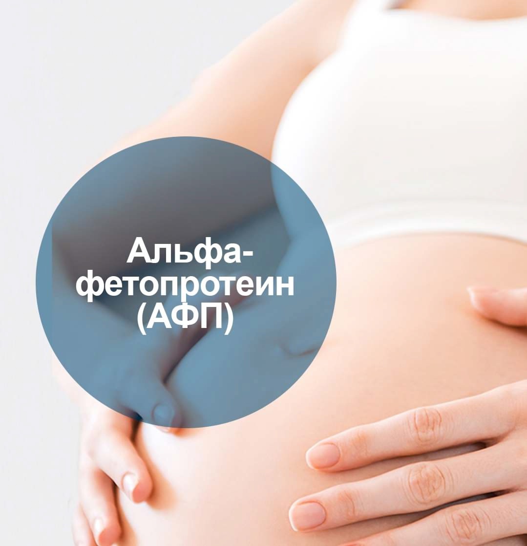 ​Альфа-фетопротеин (АФП) 