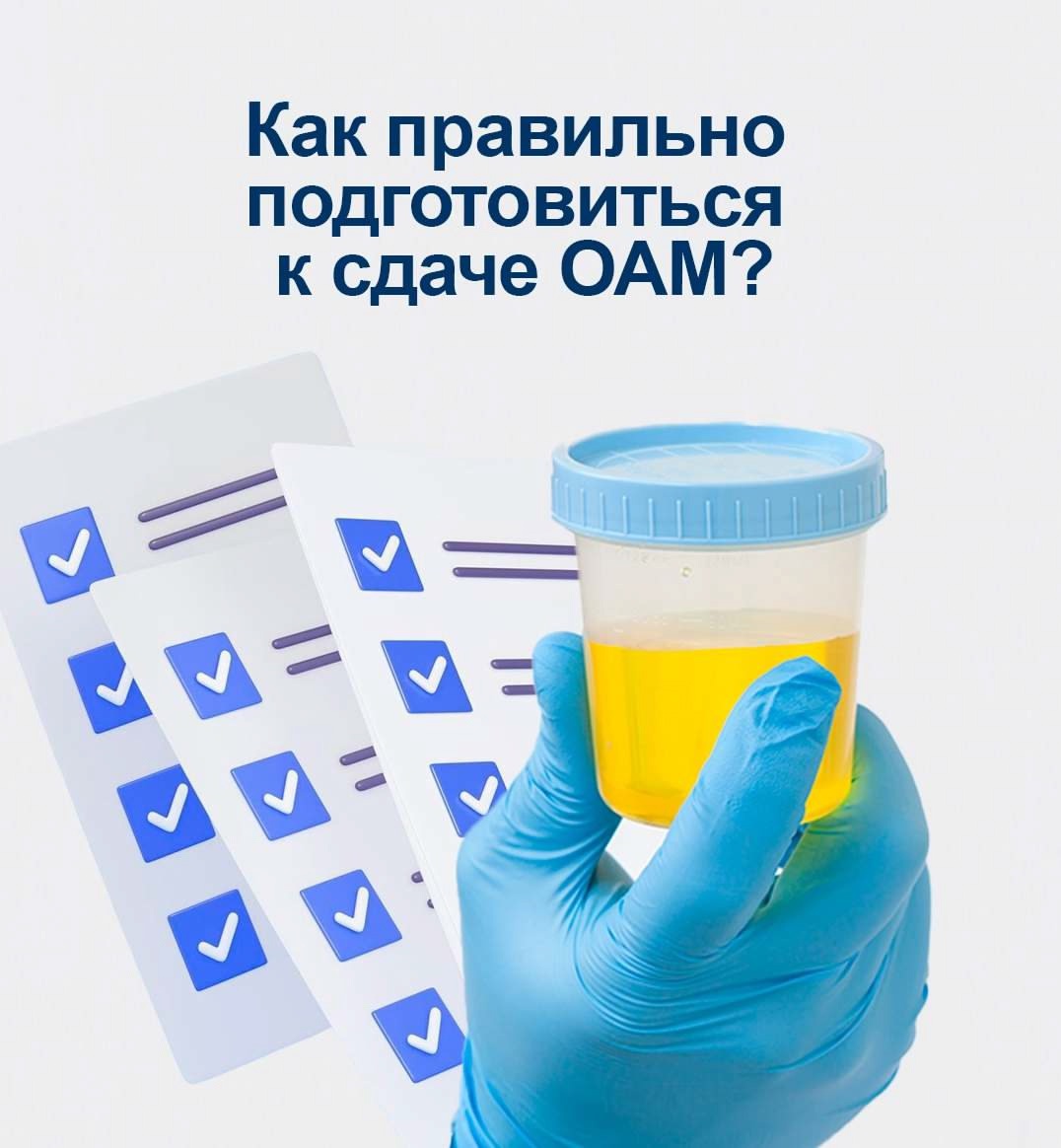 Как правильно подготовиться к сдаче общего анализа мочи
