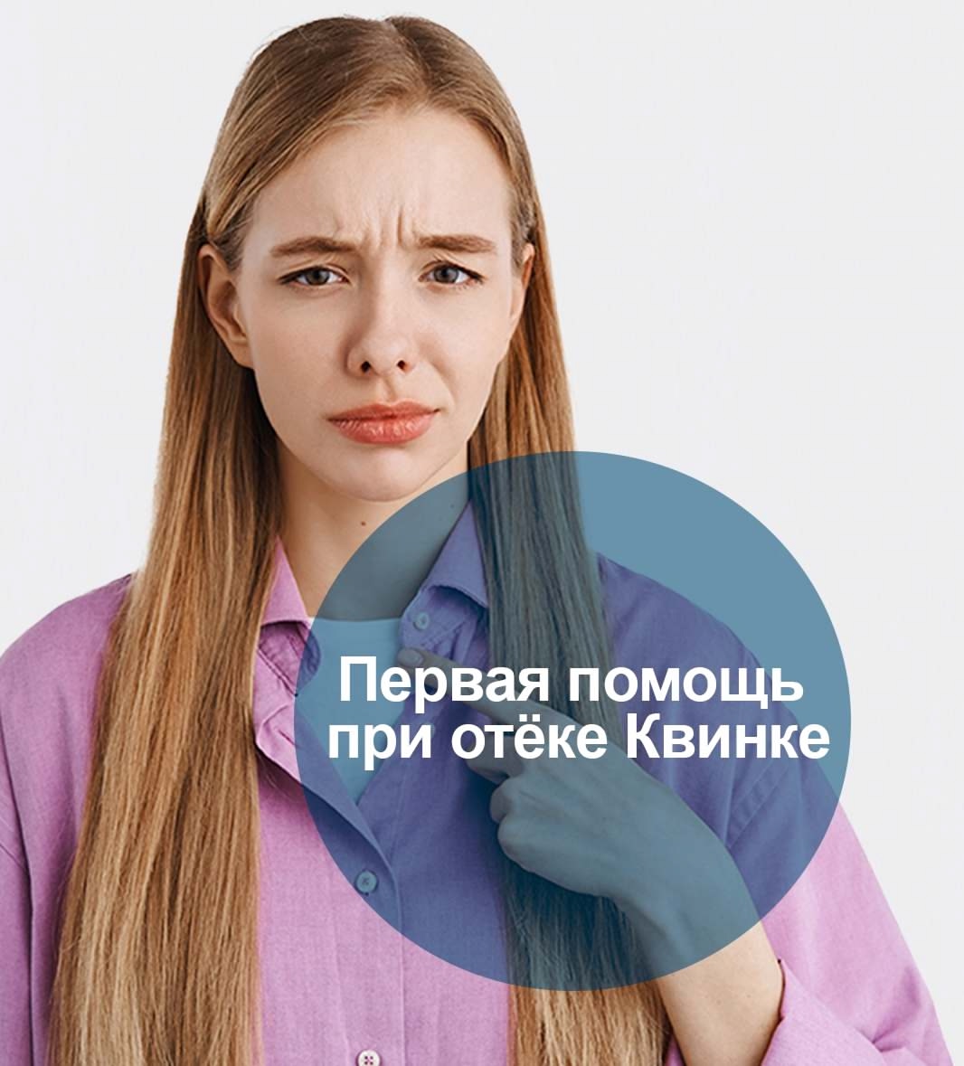 Отёк Квинке