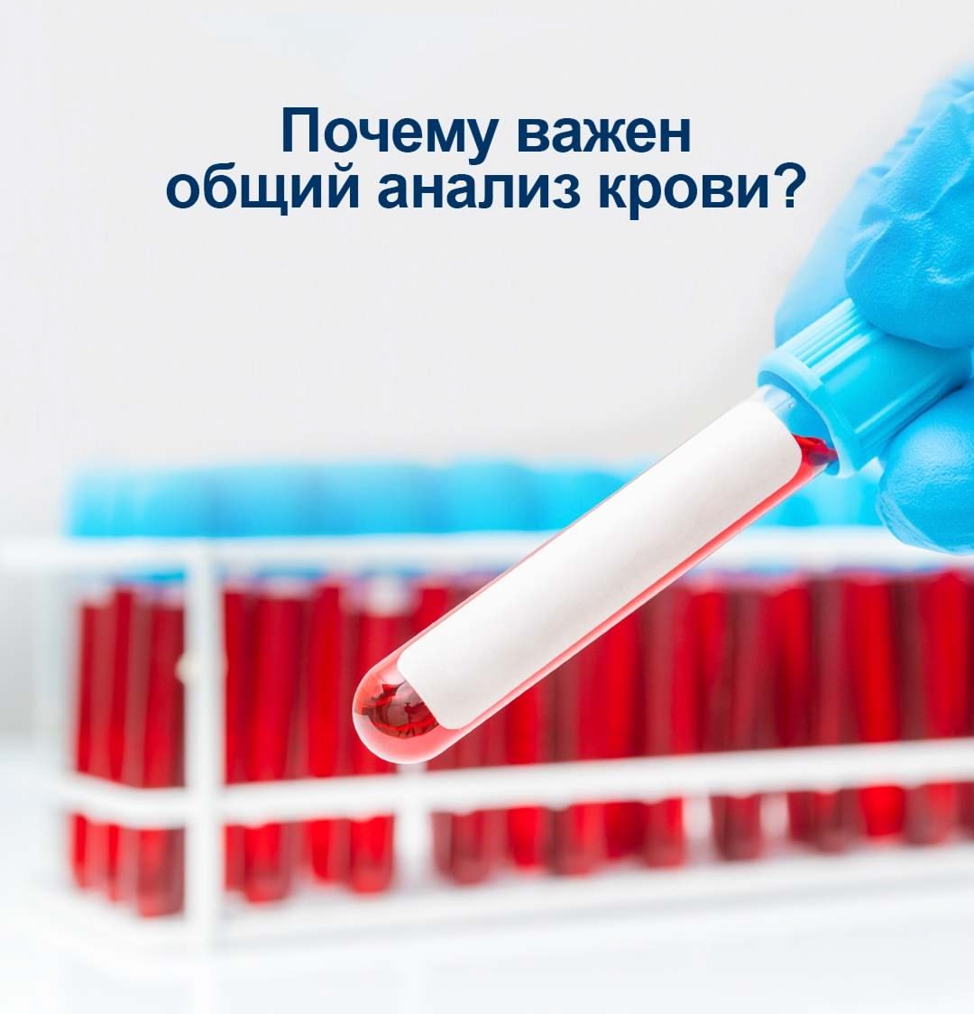 Почему важен общий анализ крови?