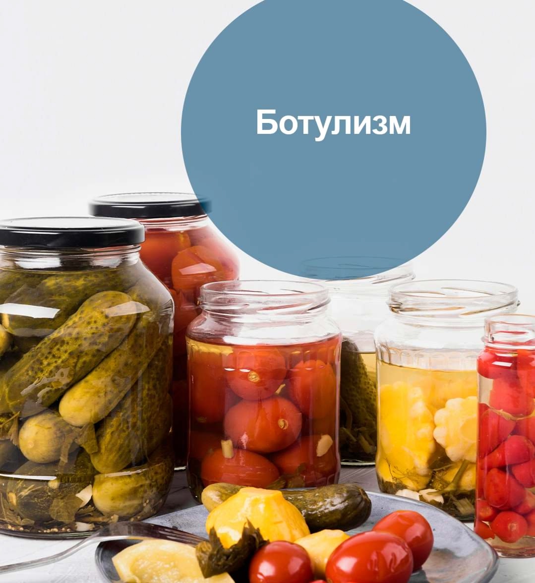 Ботулизм