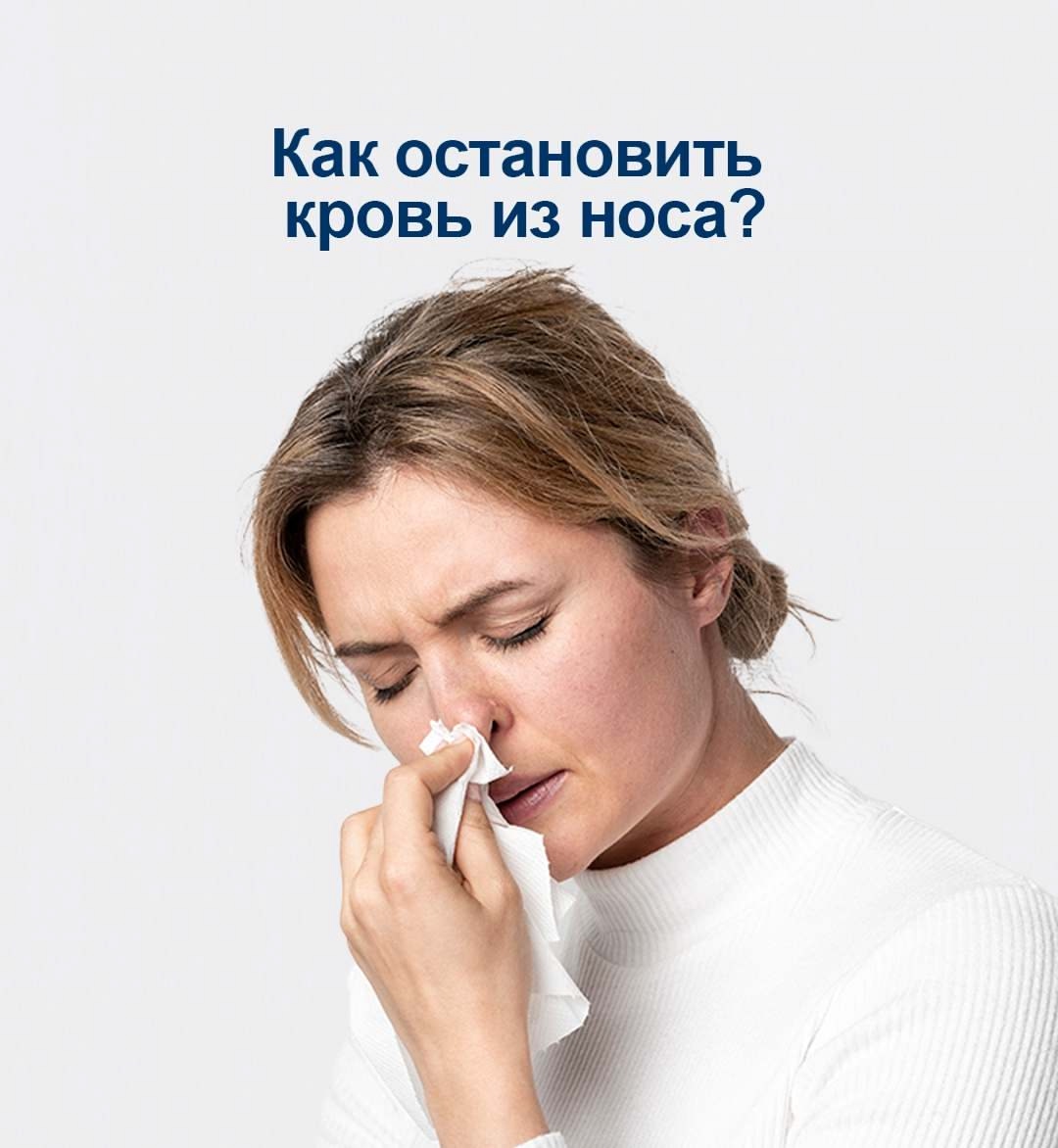 Как остановить кровь из носа