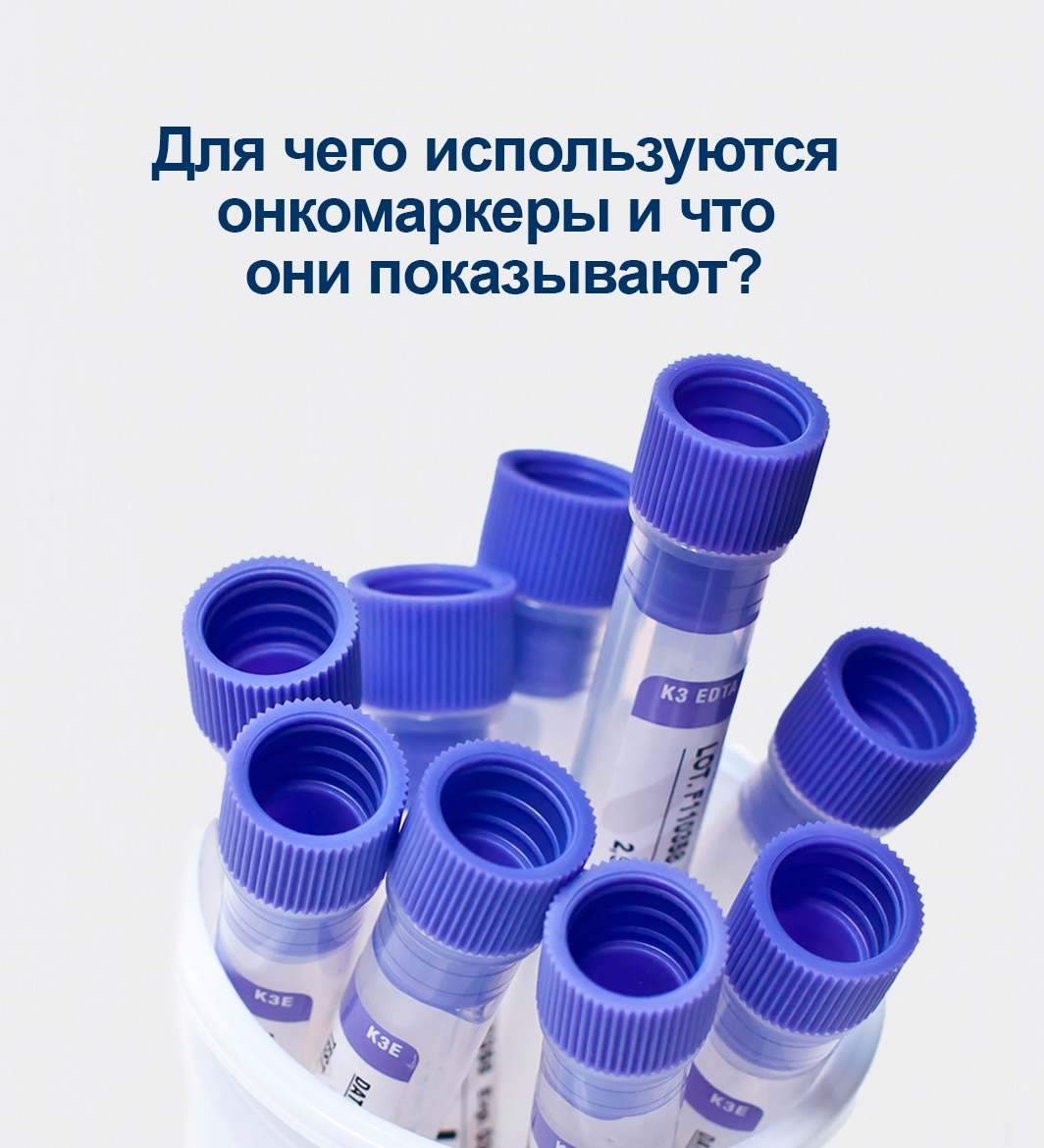 Для чего используются онкомаркеры и что они показывают?