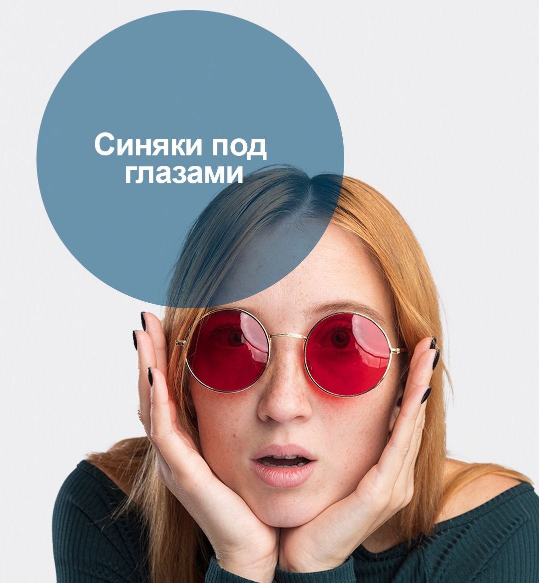 Синяки под глазами