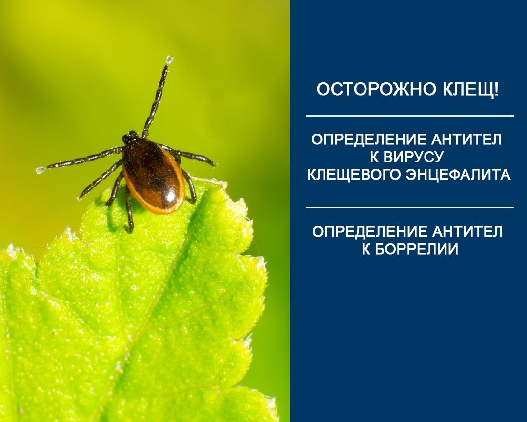 ​Сделать ПЦР исследование клеща​