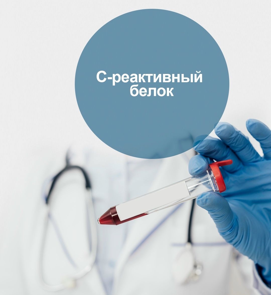 Что такое С-реактивный белок